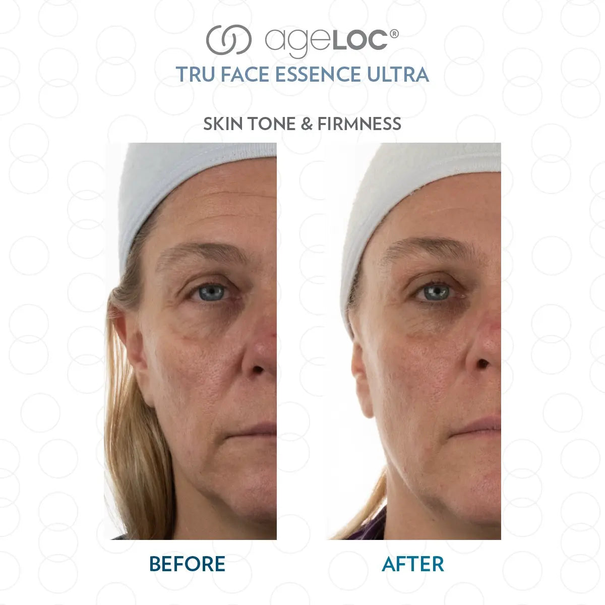SGMY_NuSkin_ageLOC_Tru_Face_Essence_Ultra_Skin_Tone_Firmness_Testimonial