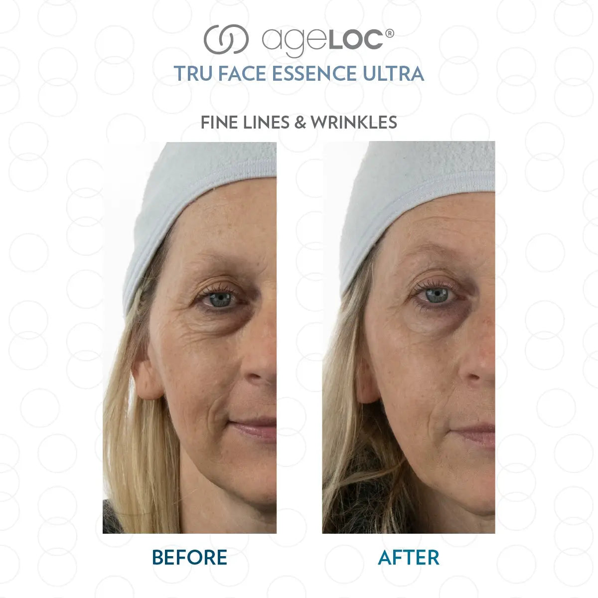 SGMY_NuSkin_ageLOC_Tru_Face_Essence_Ultra_Testimonial_2